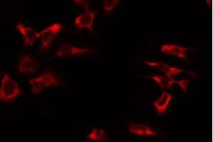 ABIN6274719 staining NIH-3T3 by IF/ICC. (MRPS17 antibody  (Internal Region))