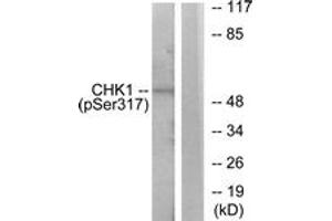 Western blot analysis of extracts from MCF7 cells, using Chk1 (Phospho-Ser317) Antibody. (CHEK1 antibody  (pSer317))