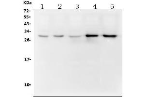 Western blot analysis of DCK using anti ZO-1 antibody (ABIN7600254).