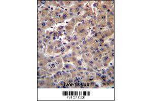 GUSB Antibody immunohistochemistry analysis in formalin fixed and paraffin embedded human liver tissue followed by peroxidase conjugation of the secondary antibody and DAB staining.