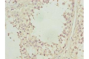 Immunohistochemistry of paraffin-embedded human testis tissue using ABIN7146719 at dilution of 1:100 (CA3 antibody  (AA 2-260))