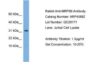 WB Suggested Anti-MRPS6  Antibody Titration: 0.