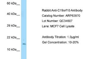 Western Blotting (WB) image for anti-Chromosome 19 Open Reading Frame 10 (C19orf10) (N-Term) antibody (ABIN2789685) (C19orf10 antibody  (N-Term))