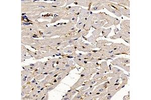 Immunohistochemistry of paraffin embedded rat heart using ANXA3 (ABIN7073065) at dilution of 1: 300 (400x lens) (Annexin A3 antibody)