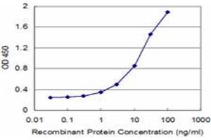 Detection limit for recombinant GST tagged LMX1B is approximately 0. (LMX1B antibody  (AA 1-110))