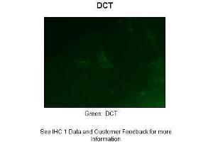 Sample Type :  Zebrafish embryo section  Primary Antibody Dilution :  1:50  Secondary Antibody :  Anti-rabbit-Alexa Fluor 488  Secondary Antibody Dilution :  1:500  Color/Signal Descriptions :  Green: DCT  Gene Name :  Dct  Submitted by :  Anonymous (DCT antibody  (Middle Region))