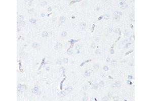 Immunohistochemistry of paraffin-embedded Rat brain endothelial cells using P Glycoprotein Polyclonal Antibody at dilution of 1:100 (40x lens). (P-Glycoprotein antibody)