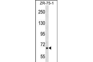 WD1 Antibody (Center) (ABIN1538147 and ABIN2849315) western blot analysis in ZR-75-1 cell line lysates (35 μg/lane). (PPWD1 antibody  (AA 236-262))