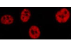 ABIN6267309 staining HeLa by IF/ICC. (C-JUN antibody  (pSer73))