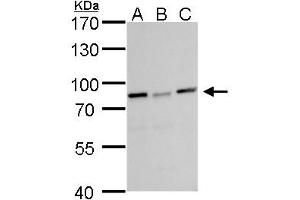 WB Image DDX3 antibody detects DDX3 protein by Western blot analysis. (DDX3X antibody  (Center))