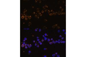 Immunofluorescence analysis of Jurkat cells using KLRC4 Polyclonal Antibody (ABIN7268115) at dilution of 1:100 (40x lens). (KLRC4 antibody  (AA 1-55))