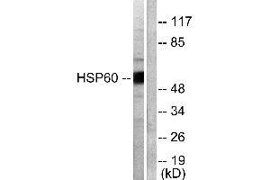 Western blot analysis of extracts from COLO205 cells, using HSP60 antibody (#C0233). (HSPD1 antibody)