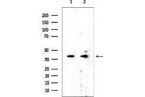 anti-AlkB, Alkylation Repair Homolog 1 (ALKBH1) antibody