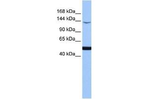 MAP3K1 antibody used at 1 ug/ml to detect target protein.