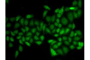 Immunofluorescence analysis of HeLa cells using ATXN1 antibody (ABIN5973659). (Ataxin 1 antibody)