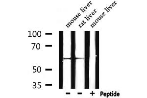 Western Blotting (WB) image for anti-Catalase (CAT) antibody (ABIN6260491)
