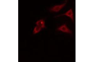 ABIN6274793 staining HT29 cells by IF/ICC. (ABHD8 antibody  (Internal Region))
