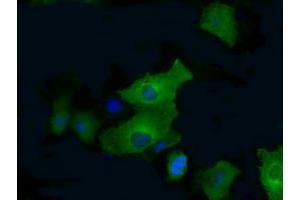 Anti-PFKFB4 mouse monoclonal antibody (ABIN2453452) immunofluorescent staining of COS7 cells transiently transfected by pCMV6-ENTRY PFKFB4 (RC201573). (PFKFB4 antibody)