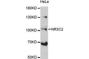 Western blot analysis of extracts of HeLa cells, using NR3C2 antibody (ABIN5971700) at 1:3000 dilution. (NR3C2 antibody)