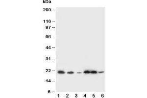 Western blot testing of SSR3 antibody and Lane 1:  rat liver;  2: rat spleen; and human samples 3: A431;  4: HeLa;  5: U87;  6: SMMC-7721 cell lysate. (SSR3 antibody  (AA 8-23))