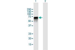 Western Blotting (WB) image for anti-Zinc Finger (CCCH Type), RNA-Binding Motif and serine/arginine Rich 2 (ZRSR2) (AA 1-482) antibody (ABIN1774824)