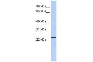 ULBP1 antibody used at 1 ug/ml to detect target protein. (ULBP1 antibody  (N-Term))
