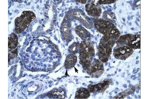 Image no. 1 for anti-GC-Rich Promoter Binding Protein 1 (GPBP1) (AA 67-116) antibody (ABIN6736275) (GC-Rich Promoter Binding Protein 1 (GPBP1) (AA 67-116) antibody)
