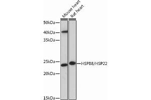 Western blot analysis of extracts of various cell lines, using HSPB8/HSP22 Rabbit mAb (ABIN6132943, ABIN6144482, ABIN6144483 and ABIN7101424) at 1:1000 dilution. (HSPB8 antibody)