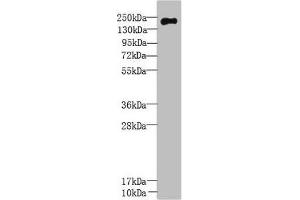 Western Blot All lanes: UBR2 antibody at 3 μg/mL + Mouse liver tissue Secondary Goat polyclonal to rabbit IgG at 1/10000 dilution Predicted band size: 201, 50, 67 kDa Observed band size: 201 kDa (UBR2 antibody  (AA 101-439))