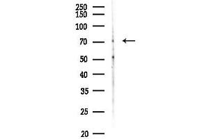 anti-Solute Carrier Family 28 (Sodium-Coupled Nucleoside Transporter), Member 1 (SLC28A1) (N-Term) antibody