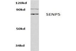 Image no. 1 for anti-SUMO1/sentrin Specific Peptidase 5 (SENP5) antibody (ABIN271958)