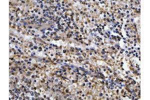 IHC analysis of CEP250 using anti-CEP250 antibody (ABIN7602053). (CEP250 antibody  (AA 563-853))