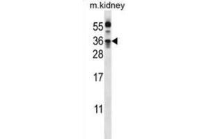 Western Blotting (WB) image for anti-Kallikrein 8 (KLK8) antibody (ABIN3002619) (Kallikrein 8 antibody)