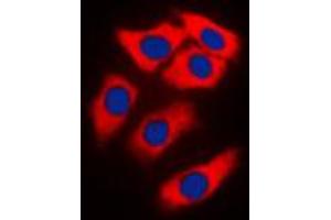 Immunofluorescent analysis of NEURL1 staining in MCF7 cells. (NEURL antibody  (Center))