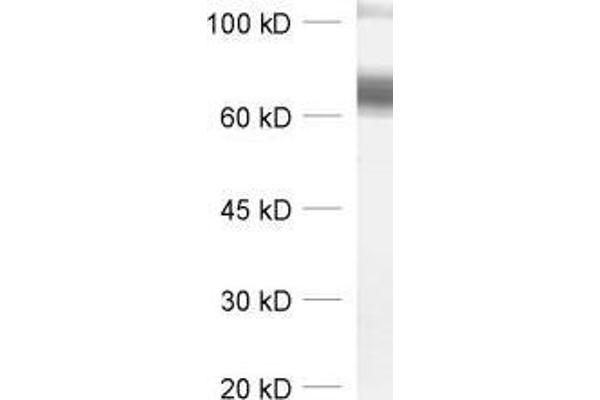 SLC6A11 anticorps