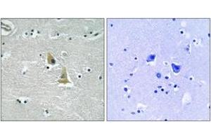 Immunohistochemistry analysis of paraffin-embedded human brain tissue, using p47 phox (Ab-345) Antibody. (NCF1 antibody  (AA 311-360))
