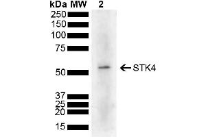 Western blot analysis of Human Cervical cancer cell line (HeLa) lysate showing detection of 55. (STK4 antibody  (AA 320-420) (HRP))