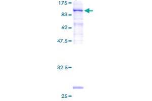 Signal Recognition Particle Receptor (Docking Protein) (SRPR) (AA 1-638) protein (GST tag)