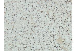Image no. 1 for anti-Androgen Receptor (AR) (AA 221-321) antibody (ABIN598541) (Androgen Receptor antibody  (AA 221-321))