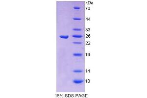 SDS-PAGE analysis of Human CBFb Protein. (CBFB Protein)
