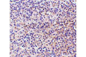 Immunohistochemistry (IHC) image for anti-CD180 Molecule (CD180) (C-Term) antibody (ABIN1030626) (CD180 antibody  (C-Term))
