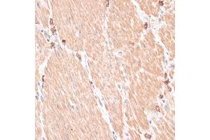 Immunohistochemistry (IHC) image for anti-ATP-Binding Cassette, Sub-Family B (MDR/TAP), Member 7 (ABCB7) (AA 503-753) antibody (ABIN7265735)