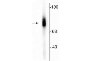 Western blot of human adrenal medulla lysate showing specific immunolabeling of the ~75 kDa DBH protein.