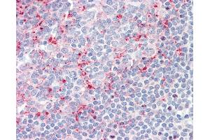 Anti-LILRB2 / ILT4 antibody IHC staining of human tonsil. (LILRB2 antibody  (C-Term))