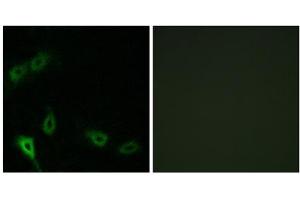 Immunofluorescence analysis of A549 cells, using MARK2 antibody. (MARK2 antibody  (N-Term))