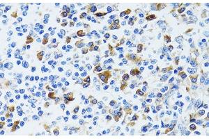 Immunohistochemistry of paraffin-embedded Human tonsil using CD63 Polyclonal Antibody at dilution of 1:100 (40x lens). (CD63 antibody)