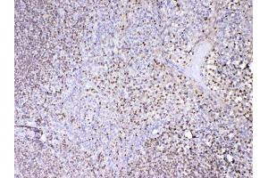 IHC analysis of PAX5 using anti-PAX5 antibody . (PAX5 antibody  (AA 217-282))