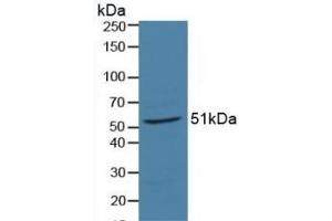 Retinoic Acid Receptor alpha antibody  (AA 68-173)