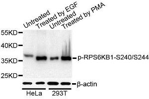 Western blot analysis of extracts of various cell lines, using Phospho-RPS6KB1-S240/244 antibody. (RPS6 antibody  (pSer240, pSer244))