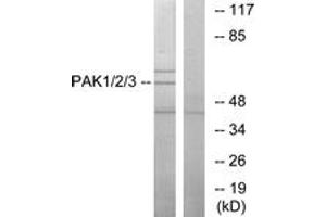 Western blot analysis of extracts from NIH-3T3 cells, using PAK1/2/3 (Ab-423/402/421) Antibody. (PAK1/2/3 antibody  (AA 391-440))
